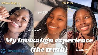 MY INVISALIGN EXPERIENCE, a review : the good, the bad, the ugly screenshot 3