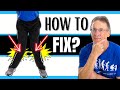 What Could Be Causing Your Knock Knees (Adults). How to Fix?