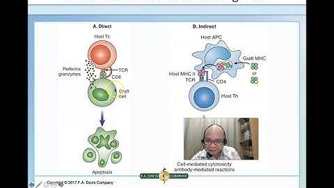 Transplant Immunology