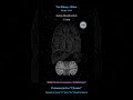 🔊 [For Speaker] 963 Hz | Kidney Detox | Water Element Sound 💧 Release All Fears #Shorts