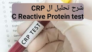 تحليل البروتين المتفاعل سي (C-Reactive Protein)( CRP) لا تنسى الاشتراك بالقناة ليصلكم كل جديد