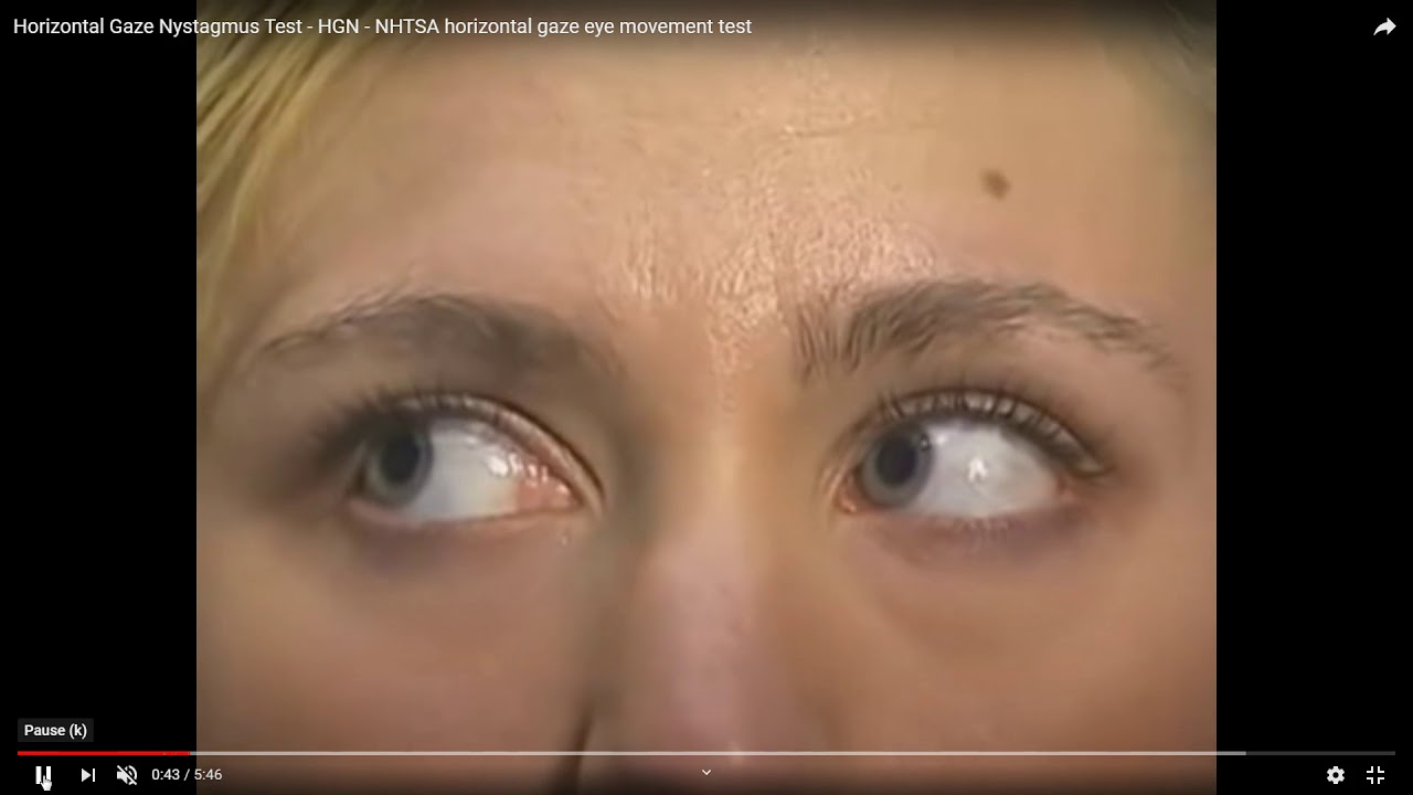 Horizontal Gaze Nystagmus 1 YouTube
