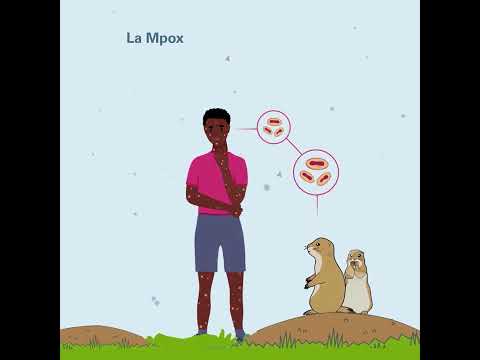 La Mpox est