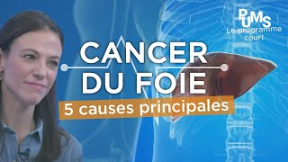 Qu'est-ce qui provoque le cancer du foie ? Quelles sont les causes ?