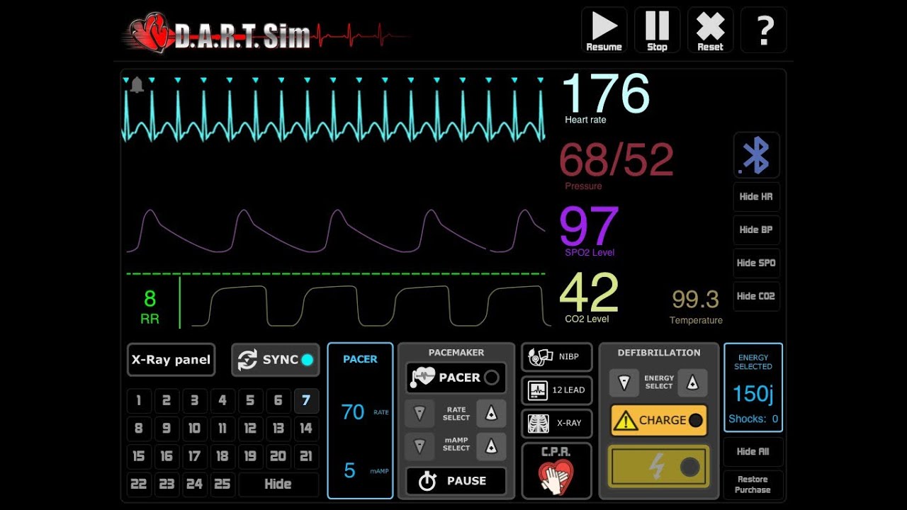 acls training center monitor tech acls training center monitor tech