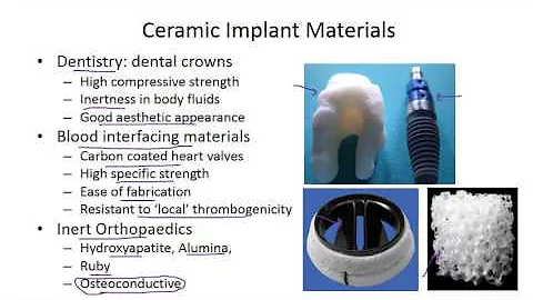 Section 4.2 Use of ceramics in medical devices and their properties - DayDayNews