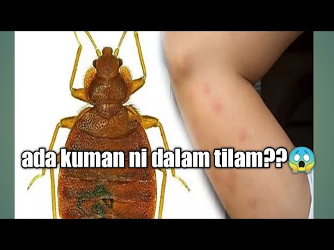 Video: Adakah anda membuang tilam?