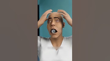 How a light bulb can trap your jaw 😳#shorts