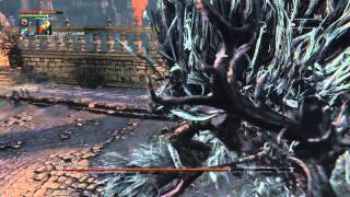 Bloodborne™ Cleric Beast Boss Fight