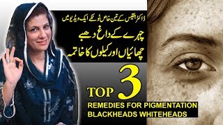 TOP 3 Remedies for  Hyper Pigmentation, Dark Spot, freckles and Black Patches by Dr. Bilquis