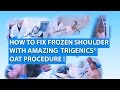 FROZEN SHOULDER CURE: Trigenics Nonsurgical Operation: OAT Procedure: TV Show: Adhesive Capsulitis