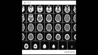 Download lagu X 77 -  'PSYOPS' full album