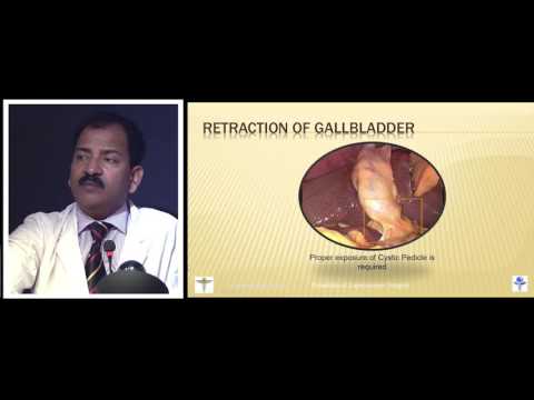 Laparoscopic Cholecystectomy Lecture By Dr R K Mishra
