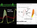 Dr. Morton Kern Discusses Aortic Stenosis Assessment