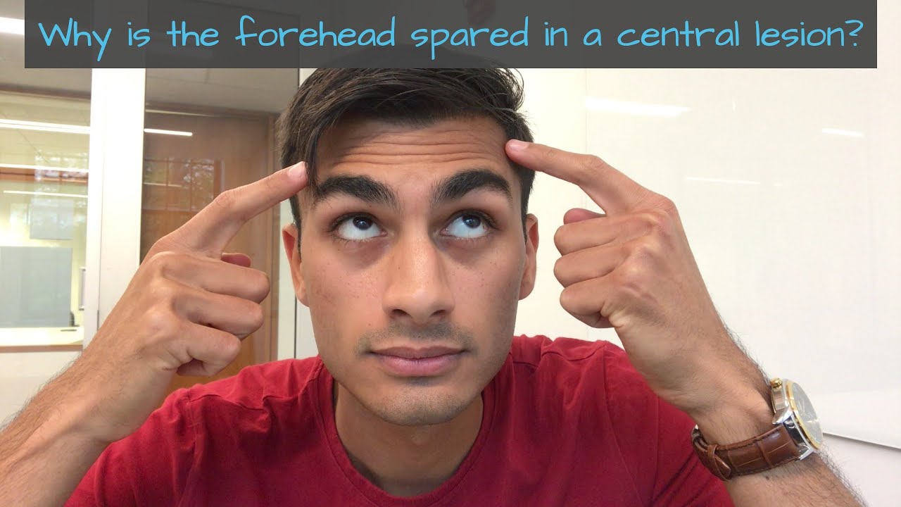 Why is the forehead spared in a central lesion? YouTube