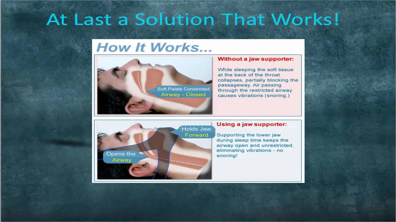 Sleep Apnea Treatment