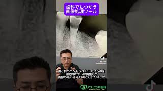 歯科でもつかう画像処理ツール