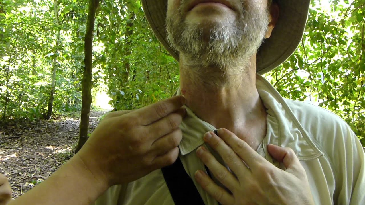 Getting rid of a leech YouTube