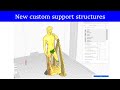 support structures in Cura - individual ansmd improved