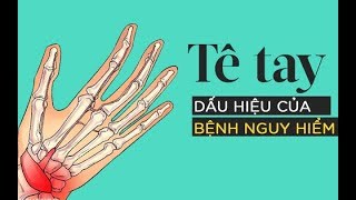 Bị tê tay vào ban đêm là dấu hiệu cảnh báo hội chứng ống cổ tay rất nguy hiểm screenshot 2