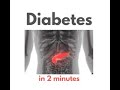 Diabetes Mellitus in under 2 mins!