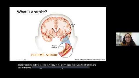 Understanding Stroke