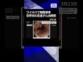 【ニュース】世界初の食道がん治療薬を了承　「ウイルス」でがん細胞を破壊　#shorts