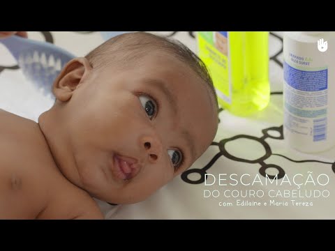 Como evitar caspas no bebê | Higiene e cuidado do bebê