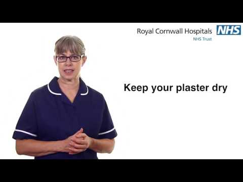 Caring for your plaster cast  Royal Cornwall Hospitals NHS Trust