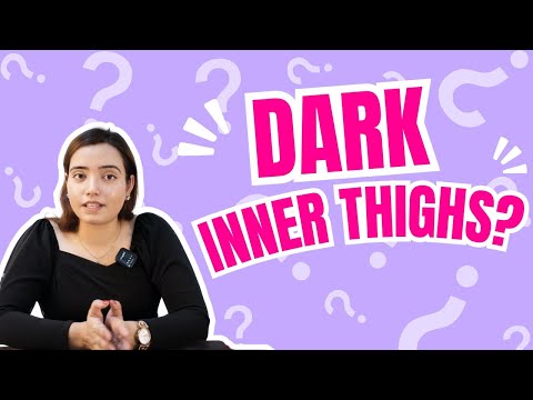 Struggling with Dark