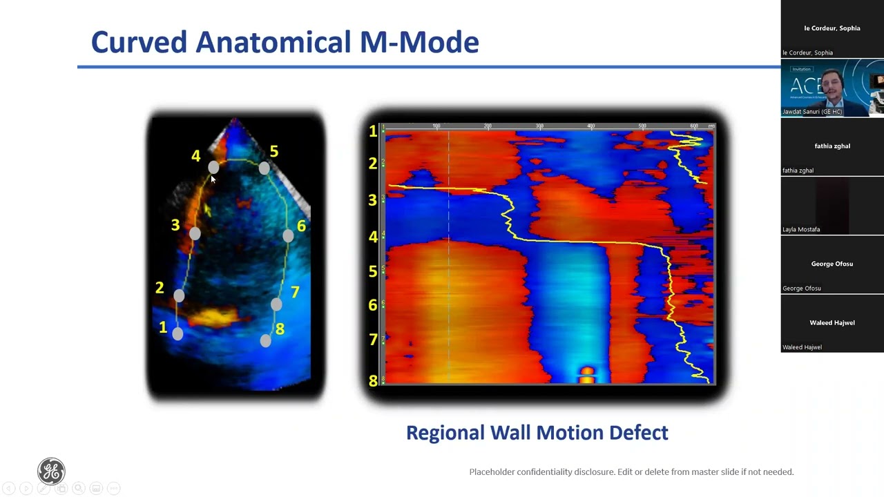 ACE Strain Echocardiography - PASCAR 09-06-2022