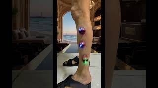 AJ cupping therapy 2026 #Hijama #CuppingTherapy #SportsRecovery #PainRelief #Wellness #healing