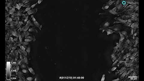 Wound healing assay - Label free 3D Live Cell Imaging by the HT-X1