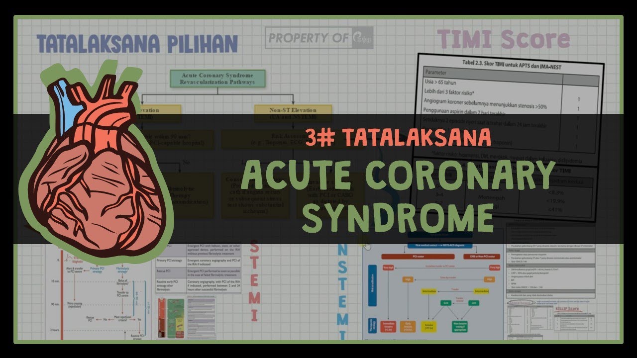 PENYAKIT JANTUNG KORONER (TATALAKSANA DAN TERAPI) #3 ACUTE CORONARY SYNDROME TREATMENT