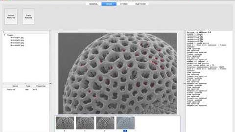 3D reconstruction from SEM images of a pollen grain