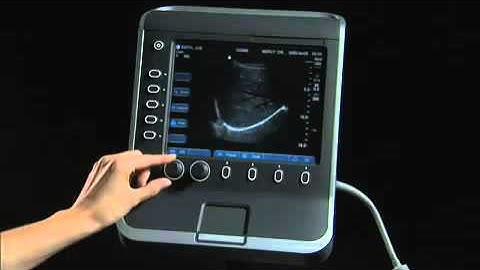 SonoSite S Series Product Training Part 2  Screen Layout   YouTube
