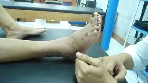 Como é feita a fisioterapia no pé?