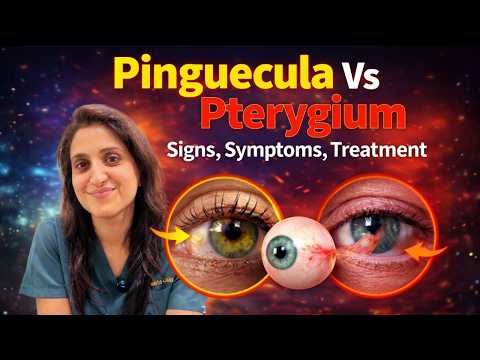 Yellow or Pink Spot on Your Eye? Pinguecula vs Pterygium