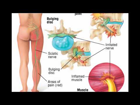 Video: Sukupuolielinten Hermon Anatomia, Toiminta Ja Kaavio - Vartalokartat