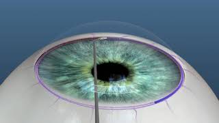 OMNI Animation procedure OMNI Animation procedure