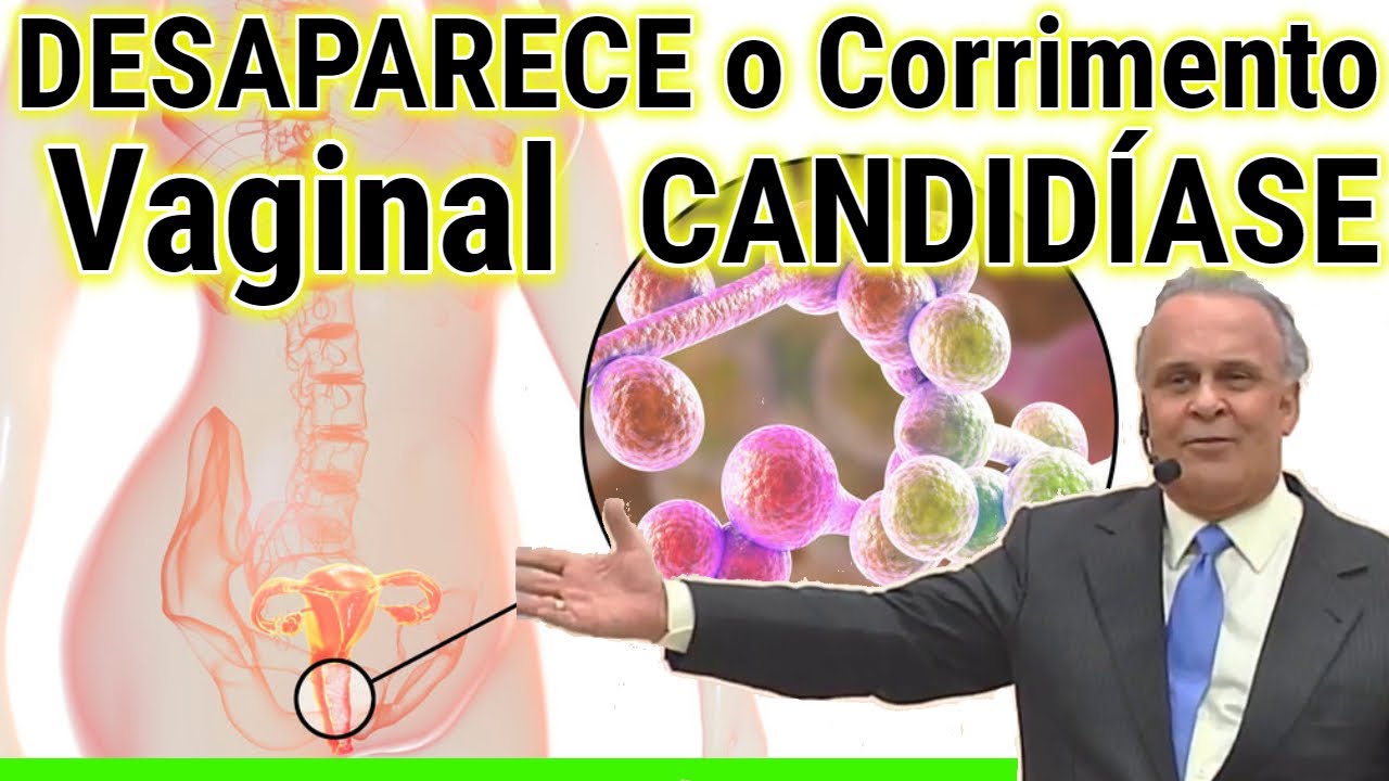 Candidíase tratar corrimento Vaginal Lair Ribeiro Candidíase - YouTube