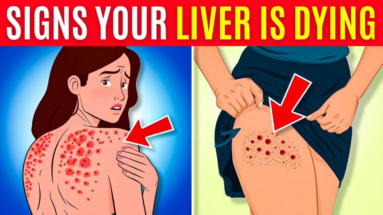 LIVER DAMAGE? These 5 Skin SIGNS Mean It's ALREADY HAPPENING!