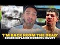 ‘BOXER SURVIVES HORRIFIC INJURY’ Jordan Flynn EXPLAINS DETAILS OF 2 BREAKS IN JAW &amp; AFTERMATH