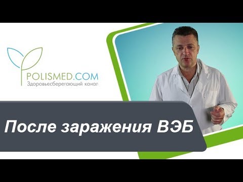 После заражения вирусом Эпштейна-Барр: действие на ЦНС, синдром хронической усталости