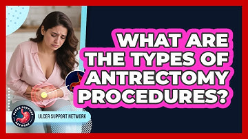 What Are The Types Of Antrectomy Procedures? - Ulcer Support Network