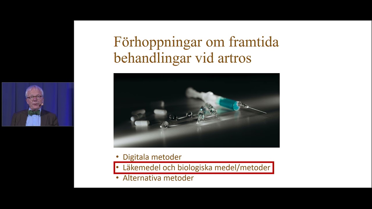 Förhoppningar om framtida behandlingar vid artros (Webinar: När minnet sviktar eller leder gör ont)