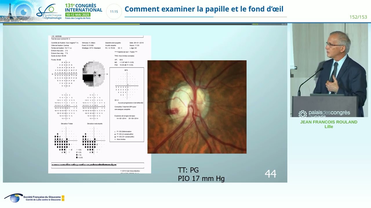 COMMENT EXAMINER LA PAPILLE ET LE FOND D'OEIL DR JF ROULAND