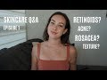 Retinoids, Acne, Texture | Skincare Q&A | Episode 1