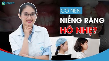 Răng hô nhẹ có nên niềng || Thời gian niềng răng hô bao lâu?