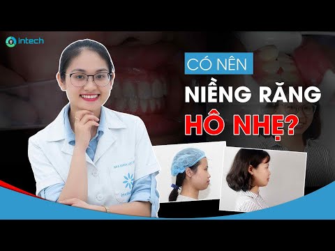 cách chăm sóc răng niềng tại Kemtrinam.vn